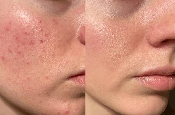 Korean Toner Pads