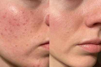 Korean Toner Pads